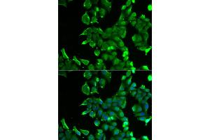 Immunofluorescence analysis of HeLa cells using STOM antibody (ABIN5973779). (Stomatin antibody)
