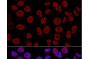 Confocal immunofluorescence analysis of Hela cells using CTCF Polyclonal Antibody at dilution of 1:200. (CTCF antibody)