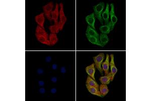 ABIN6262659 and ABIN6277905 staining Hela cells by IF/ICC. (IRG1 antibody  (C-Term))