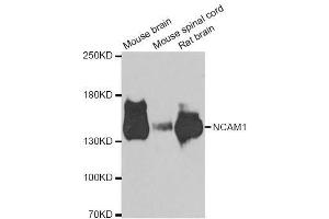Western blot analysis of extracts of various cell lines, using NCAM1 antibody. (CD56 antibody  (AA 759-858))