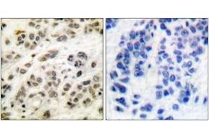 Immunohistochemistry (IHC) image for anti-Myc Proto-Oncogene protein (MYC) (AA 31-80) antibody (ABIN2888572) (c-MYC antibody  (AA 31-80))