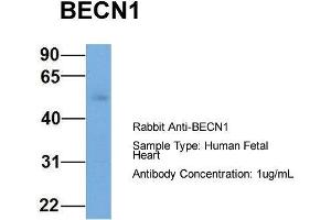 Host: Rabbit  Target Name: BECN1  Sample Tissue: Human Fetal Heart  Antibody Dilution: 1. (Beclin 1 antibody  (Middle Region))
