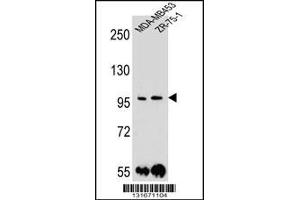 Western blot analysis in MDA-MB453,ZR-75-1 cell line lysates (35ug/lane). (Protocadherin 1 antibody  (N-Term))
