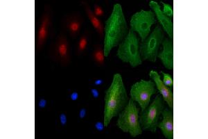 ABIN6257933 and ABIN6273786 staining  cells by IF/ICC.