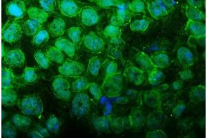 IF analysis of UBR2 using anti-UBR2 antibody (ABIN7599609). (UBR2 antibody  (AA 10-664))