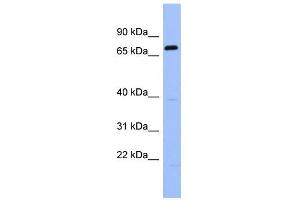WB Suggested Anti-RGS9 Antibody Titration: 0. (RGS antibody  (Middle Region))