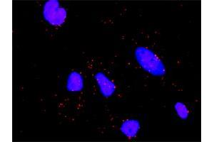 Proximity Ligation Analysis of protein-protein interactions between STK11 and STRADA. (STRADA antibody  (AA 251-346))