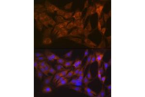 Immunofluorescence analysis of C6 cells using CLEC3B/CLEC3B/Tetranectin Rabbit mAb (ABIN1679326, ABIN3018879, ABIN3018880 and ABIN7101681) at dilution of 1:100 (40x lens).
