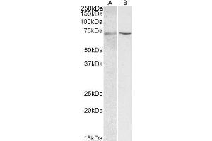 Western Blotting (WB) image for HNF1 Homeobox A (HNF1A) peptide (ABIN368836) (HNF1 Homeobox A (HNF1A) Peptide)