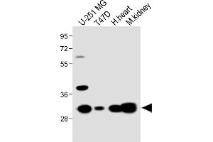 All lanes : Anti-RCH5 Antibody (N-term) at 1:1000 dilution Lane 1: U-251 MG whole cell lysate Lane 2: T47D whole cell lysate Lane 3: Hun heart lysate Lane 4: Mouse kidney lysate Lysates/proteins at 20 μg per lane. (MARCH5 antibody  (N-Term))