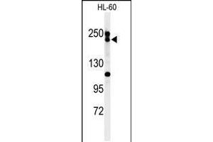 Western blot analysis of BLM Antibody in HL-60 cell line lysates (35ug/lane) (BLM antibody  (C-Term))