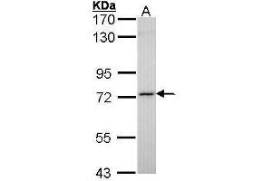 WB Image Sample (30 ug of whole cell lysate) A: Molt-4 , 7. (SDHA antibody  (N-Term))