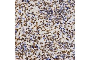 Immunohistochemistry of paraffin-embedded human kidney using DiMethyl-Histone H3-K27 antibody. (Histone 3 antibody  (H3K27me))
