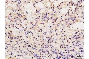 Immunohistochemistry (Paraffin-embedded Sections) (IHC (p)) image for anti-Vimentin (VIM) (AA 371-466) antibody (ABIN672786)