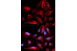 Immunofluorescence (IF) image for anti-S100 Calcium Binding Protein A11 (S100A11) (AA 1-105) antibody (ABIN6147333)
