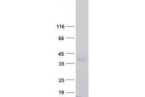 Validation with Western Blot (CD99L2 Protein (Transcript Variant 1) (Myc-DYKDDDDK Tag))