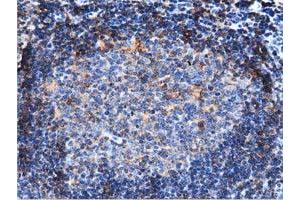 Immunohistochemical staining of paraffin-embedded Human lymph node tissue using anti-ARHGAP25 mouse monoclonal antibody. (ARHGAP25 antibody)