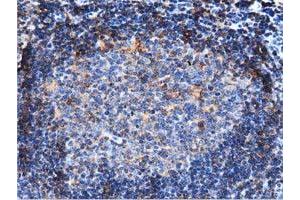 Immunohistochemical staining of paraffin-embedded Human lymph node tissue using anti-ARHGAP25 mouse monoclonal antibody.