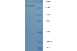 SDS-PAGE (SDS) image for Cytochrome P450, Family 4, Subfamily F, Polypeptide 11 (CYP4F11) (AA 38-524) protein (His-SUMO Tag) (ABIN5711833)