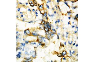 Immunohistochemistry (IHC) image for anti-Tumor Necrosis Factor Receptor Superfamily, Member 1A (TNFRSF1A) (AA 195-211), (Middle Region) antibody (ABIN3044343)