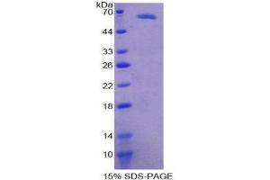 SDS-PAGE (SDS) image for CD68 Molecule (CD68) (AA 27-282) protein (His tag,GST tag) (ABIN2123578)