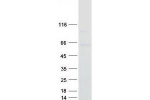 SEMA3D Protein (Myc-DYKDDDDK Tag)