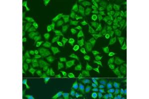 Immunofluorescence analysis of U2OS cells using PUM1 Polyclonal Antibody at dilution of 1:100. (PUM1 antibody)