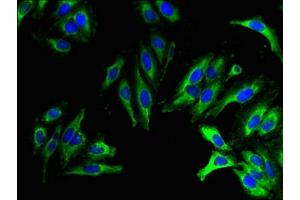 Immunofluorescent analysis of Hela cells using ABIN7173195 at dilution of 1:100 and Alexa Fluor 488-congugated AffiniPure Goat Anti-Rabbit IgG(H+L) (TMEM27 antibody  (AA 206-265))