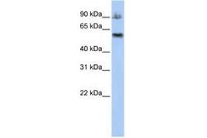 Image no. 1 for anti-Activating Signal Cointegrator 1 Complex Subunit 2 (ASCC2) (AA 612-661) antibody (ABIN6740783)
