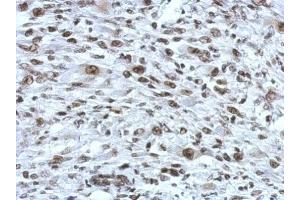 Immunohistochemistry (IHC) image for anti-RAD21 Homolog (RAD21) (Center) antibody (ABIN2856242)