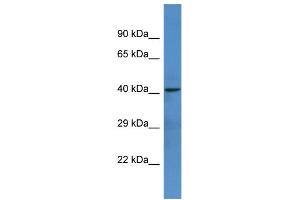 Western Blotting (WB) image for anti-Netrin G1 (NTNG1) (C-Term) antibody (ABIN2788417) (Netrin G1 antibody  (C-Term))