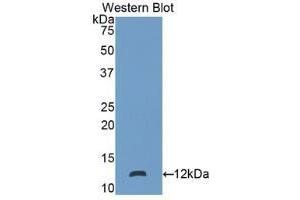 Detection of recombinant S100P using Polyclonal Antibody to S100 Calcium Binding Protein P (S100P) (S100P antibody  (AA 1-95))
