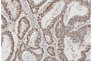 IHC analysis of PC4/SUB1 using anti-PC4/SUB1 antibody (ABIN7602185).