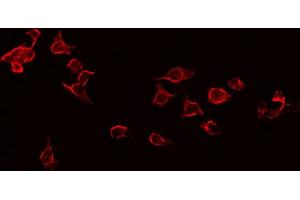 ABIN6268971 staining Hela by IF/ICC. (CD247 antibody  (pTyr142))