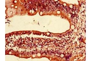 Immunohistochemistry of paraffin-embedded human small intestine tissue using ABIN7158670 at dilution of 1:100 (LYRM2 antibody  (AA 1-88))