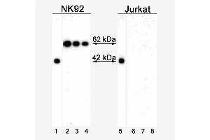 Analysis of T-bet Expression by Western Blot and Immunohistochemistry. (T-Bet antibody)