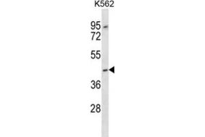 Western Blotting (WB) image for anti-Olfactory Receptor, Family 13, Subfamily F, Member 1 (OR13F1) antibody (ABIN2997241)