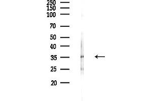 anti-Acetyl-CoA Acyltransferase 1 (ACAA1) (N-Term) antibody