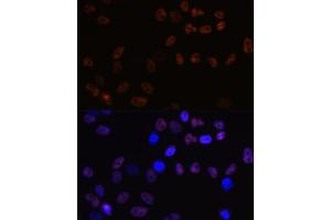 Immunofluorescence analysis of HeLa cells using MCM7 Rabbit mAb (ABIN7268544) at dilution of 1:100 (40x lens). (MCM7 antibody)
