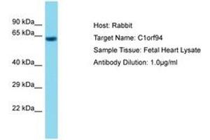 Image no. 1 for anti-Chromosome 1 Open Reading Frame 94 (C1ORF94) (AA 317-366) antibody (ABIN6750714) (C1ORF94 antibody  (AA 317-366))