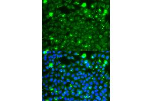 Immunofluorescence analysis of A549 cells using HSPE1 antibody. (HSPE1 antibody)