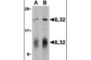 Western Blotting (WB) image for anti-Interleukin 32 (IL32) (C-Term) antibody (ABIN1030437) (IL32 antibody  (C-Term))