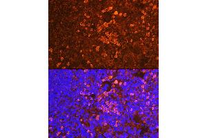 Immunofluorescence analysis of mouse spleen using CD19 Rabbit pAb (ABIN3023663, ABIN3023664, ABIN3023665 and ABIN6219683) at dilution of 1:100 (40x lens). (CD19 antibody  (AA 351-556))