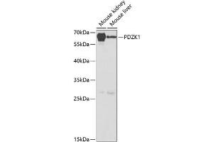 Western blot analysis of extracts of various cell lines, using PDZK1 antibody (ABIN6128428, ABIN6145422, ABIN6145423 and ABIN6220948) at 1:1000 dilution.