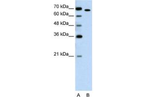 Western Blotting (WB) image for anti-RAR-Related Orphan Receptor A (RORA) antibody (ABIN2462864) (RORA antibody)