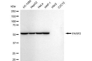 Western blotting analysis using PARP2 antibody (ABIN7799868).