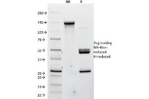 SDS-PAGE Analysis Purified P-Cadherin Mouse Monoclonal Antibody (12H6). (P-Cadherin antibody)