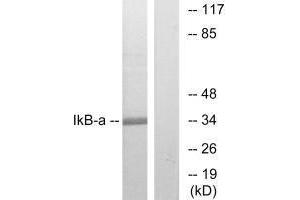 Western Blotting (WB) image for anti-Nuclear Factor of kappa Light Polypeptide Gene Enhancer in B-Cells Inhibitor, alpha (NFKBIA) (Ser32), (Ser36) antibody (ABIN7180025)