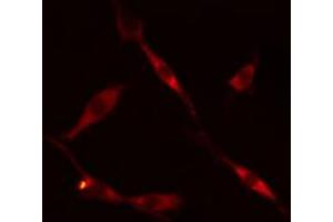 ABIN6269205 staining 293 cells by IF/ICC. (SHC1 antibody)