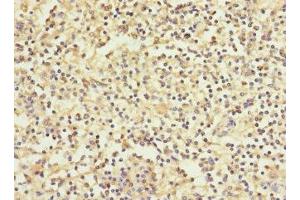 Immunohistochemistry of paraffin-embedded human spleen tissue using ABIN7166279 at dilution of 1:100 (WFDC11 antibody  (AA 26-87))